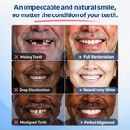 Full Set Natural Dentures Upper & Lower Silicone Fake Teeth Braces Comfort Fit 